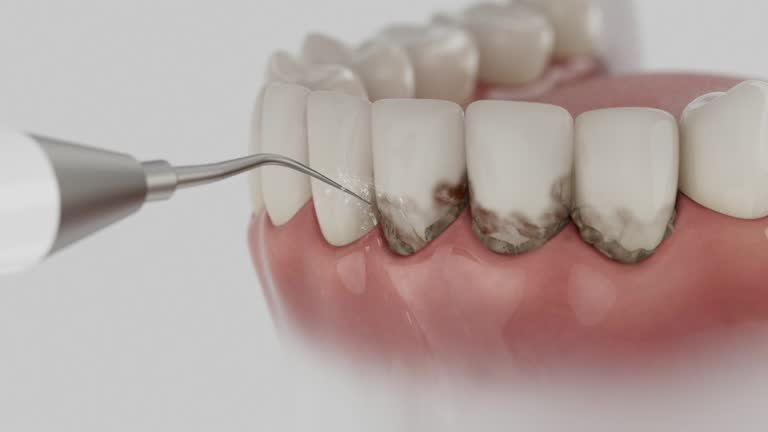 Reliable Tooth Extraction contractor in Appling County County, GA by Dentist Open Now